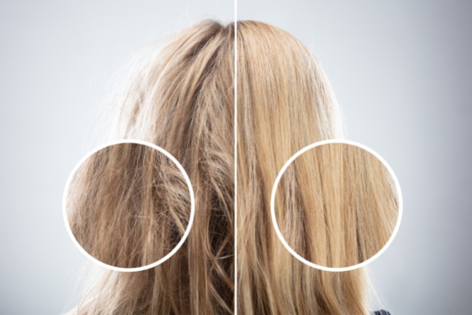 Dầu dừa có công dụng gì mang đến tóc: Phục hồi tóc hư hỏng tổn