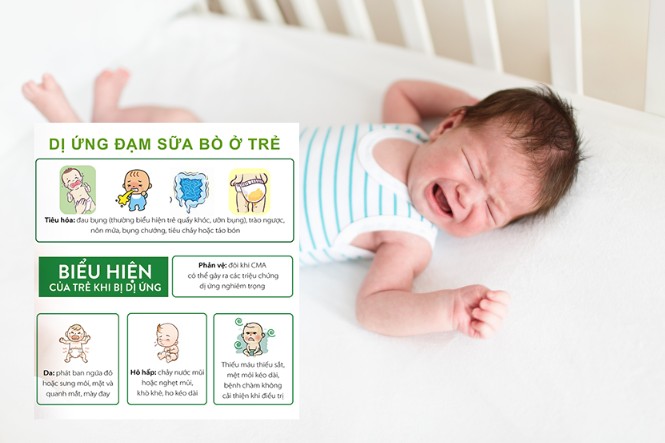 Những biểu hiện dị ứng đạm sữa bò