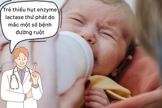 Trẻ thiếu hụt enzyme khiên bé bất dung nạp lactose