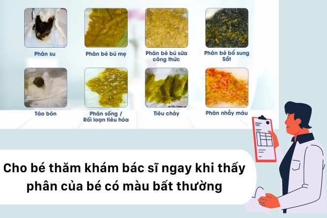 Quan sát số lần đi ngoài của trẻ theo tháng tuổi và màu sắc phân