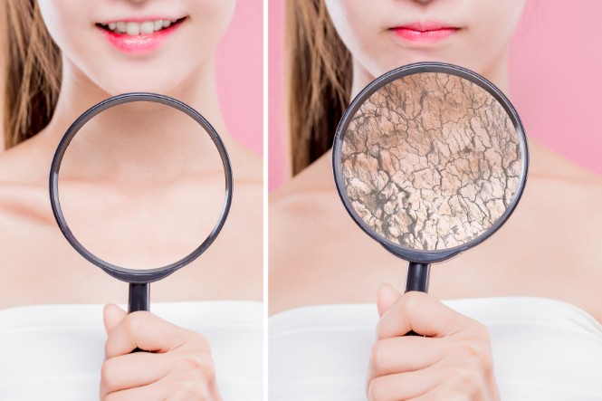 Tác hại của dầu dừa với mặt: Gây khô da