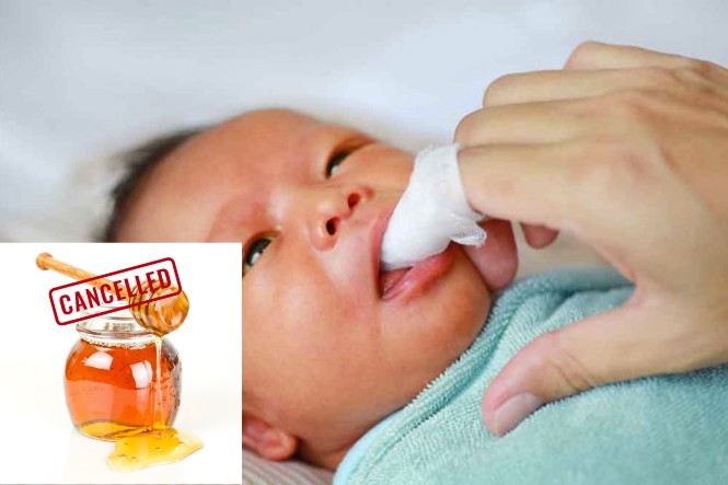 Không nên tưa lưỡi cho trẻ bằng mật ong