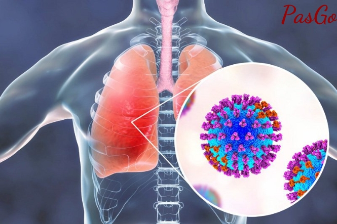 Bệnh cúm A ở trẻ em có nguy hiểm không: Trẻ có nguy cơ mắc viêm phổi