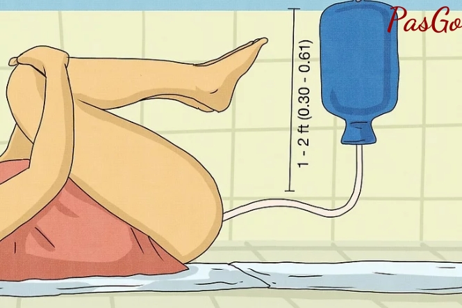 Hãy thả lỏng để dịch tự chảy vào trực tràng