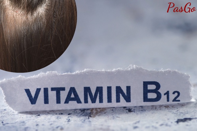 Thiếu vitamin B12 có thể gián tiếp gây ra tình trạng tóc bạc sớm