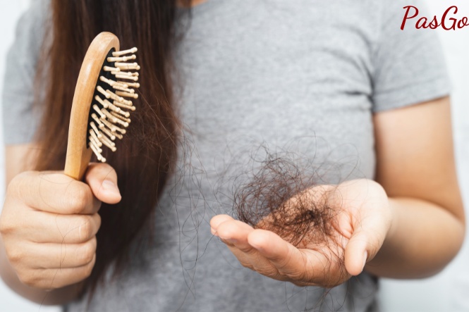 Rụng tóc nhiều có thể là dấu hiệu cảnh báo cơ thể bạn đang thiếu dưỡng chất
