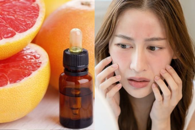 Da nhạy cảm nên cẩn thận khi dùng tinh dầu bưởi